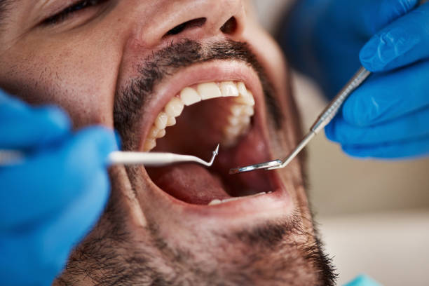 Best Pediatric Emergency Dentist in Batavia, NY