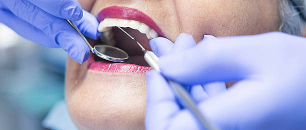 Best Emergency Dentist for Knocked-Out Tooth in Batavia, NY